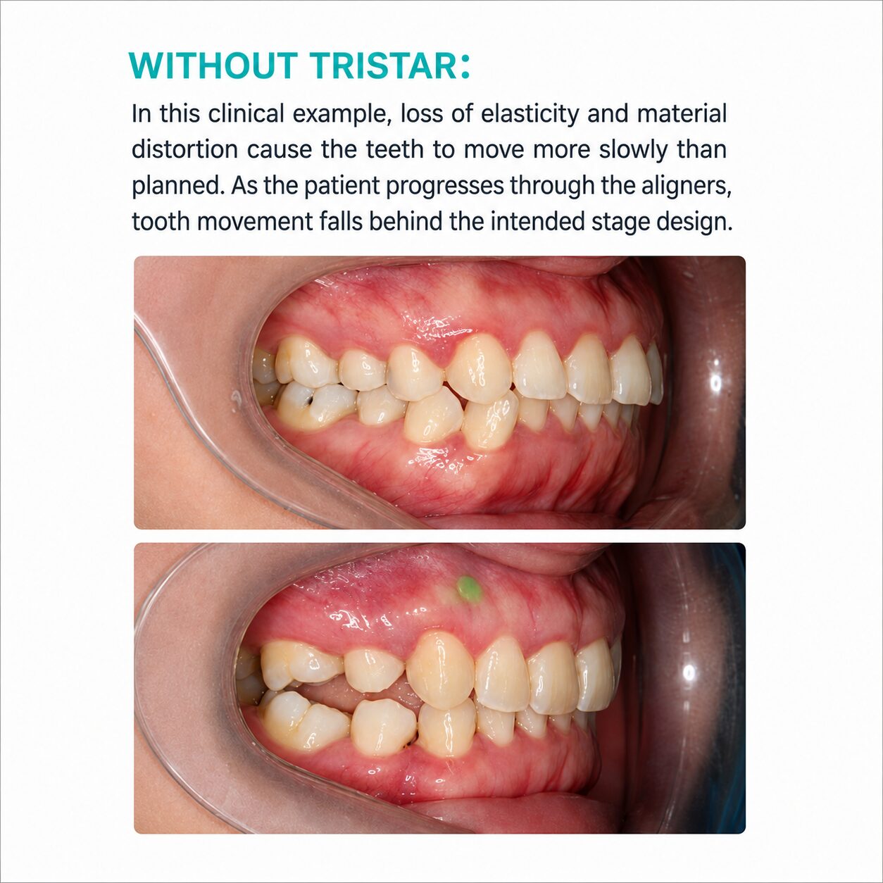 Tristar Trubalance 0.76x125 mm - Image 2